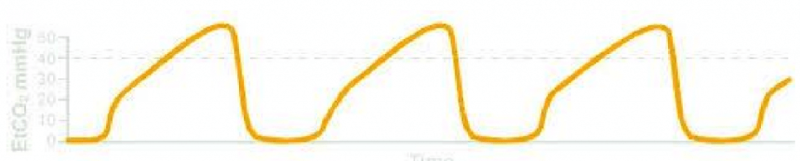 grafico curve
